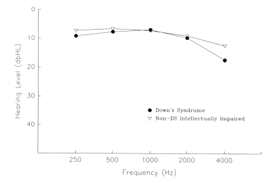 Figure 3: Pure tone bone conduction thresholds for each group, Years 1-3 combined
